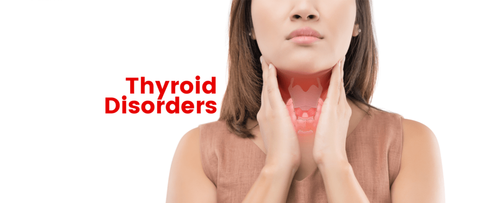 Thyroid Disorders- Types And Symptoms